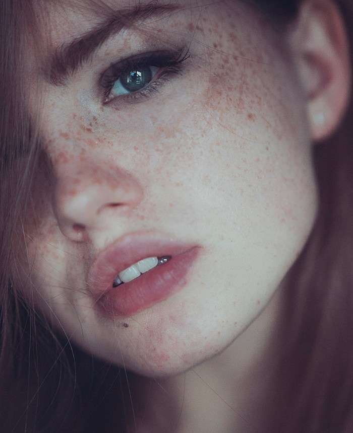 Lovely Freckles.jpeg